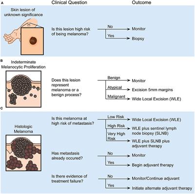 Molecular Biomarkers for Melanoma Screening, Diagnosis and Prognosis: Current State and Future Prospects